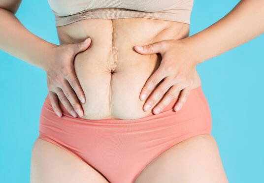 abdominoplasty-vs-tummy-tuck-image