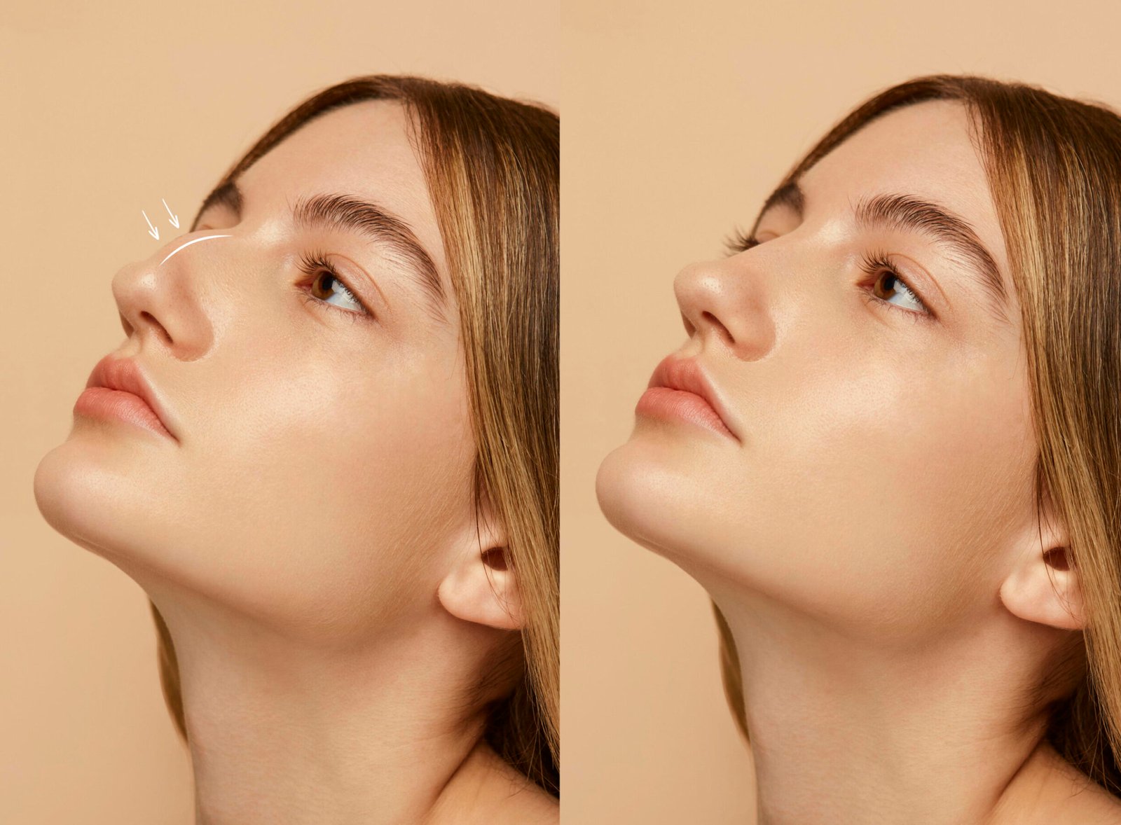 woman-getting-ready-nose-job-surgery