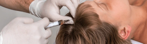hair_transplant_banner